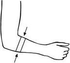 Bort 122600 Epibasic, Epicondylitis Support with Padding - Tendonitis Brace, Golfers Elbow Brace, Tennis Brace, for Arthritis, Elbow Pain, Sport Cool Max, (xx-Small, Sport, 7.9" – 8.7" inches)