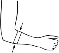 Bort 122600 Epibasic, Epicondylitis Support with Padding - Tendonitis Brace, Golfers Elbow Brace, Tennis Brace, for Arthritis, Elbow Pain, Sport Cool Max, (xx-Small, Sport, 7.9" – 8.7" inches)