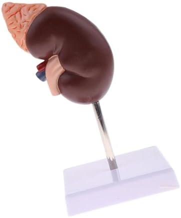 Human Kidney Model, Kidney Model Anatomy 24 Pointers for Learning