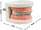 Standard Orthodontic Teeth Model, YOUYA DENTAL Demonstration Orthodontic Model Teeth Teach Study Tools with 1/2Metal and 1/2Ceramic Bracket (1/2Metal and 1/2Ceramic)