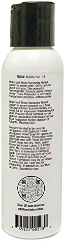 Naturasil Tinea Versicolor Treatment Lotion - Max-Strength 10x Sulfur Lotion for Fast-Acting Antifungal Relief | Soothes and Restores Skin Health 113g