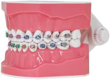 Typodonts Orthodontics Demonstration Model with Metal Wires and Bracket Teaching, Learning, Interpretation Model for Adults and Children (Metal Bracket)