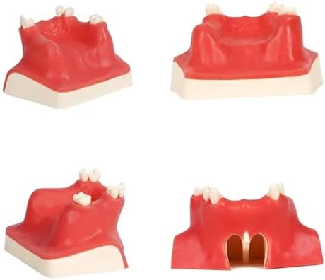 Dental Implant Training Model with Maxillary Sinus Lift Practice Realistic Simulation Jaw Cavity Lift Implant Placement Model