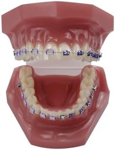 Orthodontic Dental Model with Brackets, YOUYA DENTAL Demonstration Orthodontic Model for Educational, Teeth Demonstration Typodont Anatomic Teaching Tool with 1/2 Metal and 1/2 Ceramic Bracke