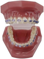 Orthodontic Dental Model with Brackets, YOUYA DENTAL Demonstration Orthodontic Model for Educational, Teeth Demonstration Typodont Anatomic Teaching Tool with 1/2 Metal and 1/2 Ceramic Bracke