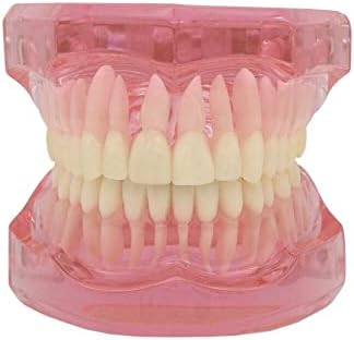 Orthodontic Metal/Ceramic/Invisible Brackets Lingual Brace Teeth Model (M3004: Invisible Metal Bracket Orthodontic Model)
