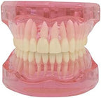 Orthodontic Metal/Ceramic/Invisible Brackets Lingual Brace Teeth Model (M3004: Invisible Metal Bracket Orthodontic Model)