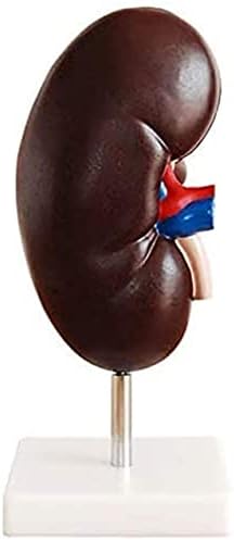 Anatomy Model 2X Magnification Human Kidney Model - Medical Kidney Model Human Organ Model Detachable Kidney Structure Adrenal Gland for Study Teaching for Medic
