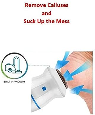 Electric Vacuum Foot File - Adsorption Grinder USB Electronic Callus Remover Feet Care Perfect for Dead Skin/Powerful Exfoliation (Blue)