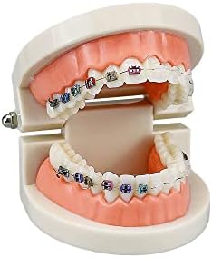Standard Orthodontic Teeth Model, YOUYA DENTAL Demonstration Orthodontic Model Teeth Teach Study Tools with 1/2Metal and 1/2Ceramic Bracket (1/2Metal and 1/2Ceramic)