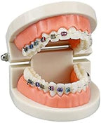 Standard Orthodontic Teeth Model, YOUYA DENTAL Demonstration Orthodontic Model Teeth Teach Study Tools with 1/2Metal and 1/2Ceramic Bracket (1/2Metal and 1/2Ceramic)