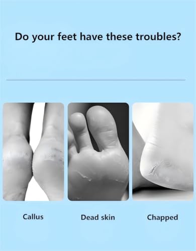 Professional Stainless Steel Foot File, Detachable Pedicure Rasp, Colossal Foot Scrubber for Hard Skin Removal, Wet and Dry Use