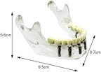 Dental Implant Practice Model, YOUYA DENTAL Maxillary Sinus Implant Model Dental Mandibular Sinus with Soft Gums for Dentist Student Studying Teaching Training Teaching Demonstration Clinic Model