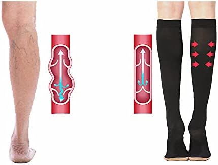 Compression Stockings, 23-32mmHg, Unisex Compression Stockings, Eliminate The Swelling and Soreness Caused by Varicose Veins and Venous Blood Return Disorder. -M