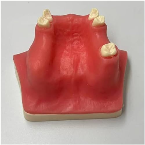 VERIMP Implant Model Maxillary Sinus Lifting Exercise Soft Gums Maxillary Sinus Lift Practice Model - Dental Implant Practice Model - Oral Simulation Implant Soft Gum Dental Material