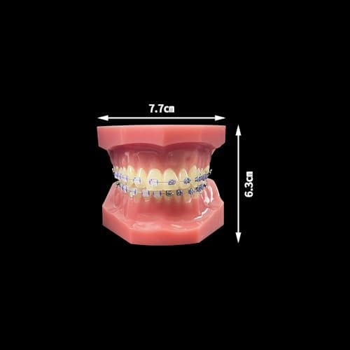 Orthodontic Dental Model with Brackets, YOUYA DENTAL Demonstration Orthodontic Model for Educational, Teeth Demonstration Typodont Anatomic Teaching Tool with 1/2 Metal and 1/2 Ceramic Bracke