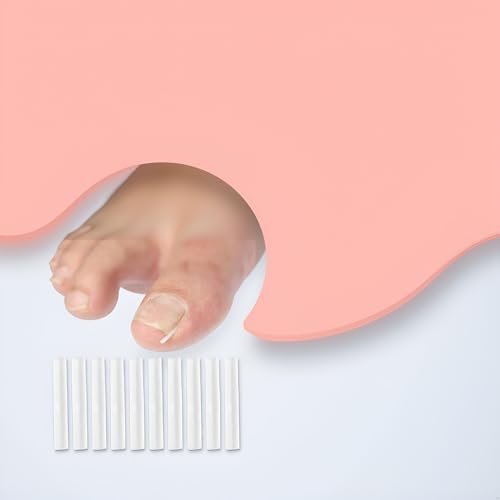10Pcs White Ingrown Toenail Correction Strips Brace Kit, Ingrown Toenail Corrector Straightener Strips Recover Toenails Thick Pedicure Tool Toenail Straightener Strip for Men Women Foot Care Tool