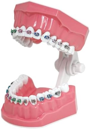 Typodonts Orthodontics Demonstration Model with Metal Wires and Bracket Teaching, Learning, Interpretation Model for Adults and Children (Metal Bracket)