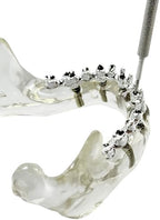 Dental Implant Practice Model, YOUYA DENTAL Maxillary Sinus Implant Model Dental Mandibular Sinus with Soft Gums for Dentist Student Studying Teaching Training Teaching Demonstration Clinic Model