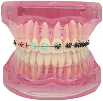 Dental Model, Orthodontic Typodont, Teeth Model Braces, Arch Wire, Metal Ceramic Bracket, Invisible Retainer, Single Buccal Tube, Ligature Ties, Teaching Practice Demonstration (M3012)