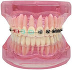 Dental Model, Orthodontic Typodont, Teeth Model Braces, Arch Wire, Metal Ceramic Bracket, Invisible Retainer, Single Buccal Tube, Ligature Ties, Teaching Practice Demonstration (M3012)