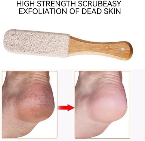 2-Pack Professional Pedicure Foot File & Pumice Stone - Callus Remover and Foot Scrubber for Dead Skin, Dry Rough Feet and Cracked Heels