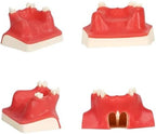 Dental Tooth Model Teeth Typodonts Dental Implant Maxillary Sinus Model Lift Practice Model for Training Teaching Demo and Study