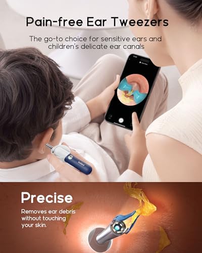 Bebird Earsight Plus R37R Ear Cleaning Camera Wax Removal Tool kit, FSA HSA Eligible Flexible Ear Scope Otoscope Camera Light, Visual Ear Picker Wireless Earwax Remover Tweezers for Adults & Kids