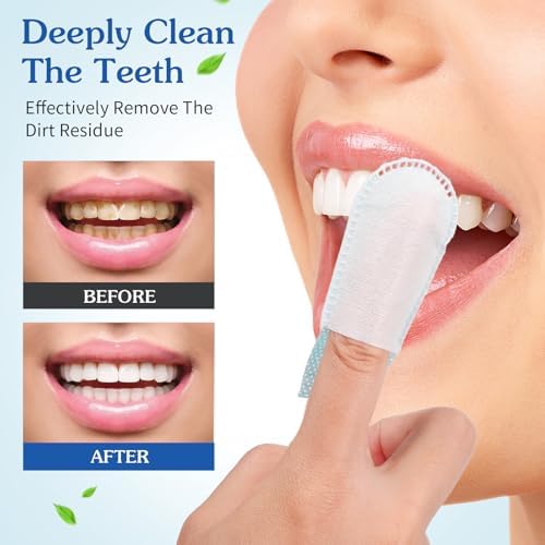 Cleaning Wipes 50 Pcs Disposable Deep Cleaning Teeth Wipes Finger Toothbrush Oral Finger Wipes Teeth Whitening Wipes Oral Cleaning Wipe for Oral Brush Ups Mini Toothbrush