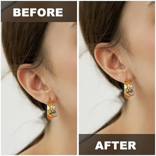 100 Patches Ear Lobe Support Patches for Earrings - Prevents Stretching，Protects Healthy Ear Lobes from Tearing - Clear & Latex-Free