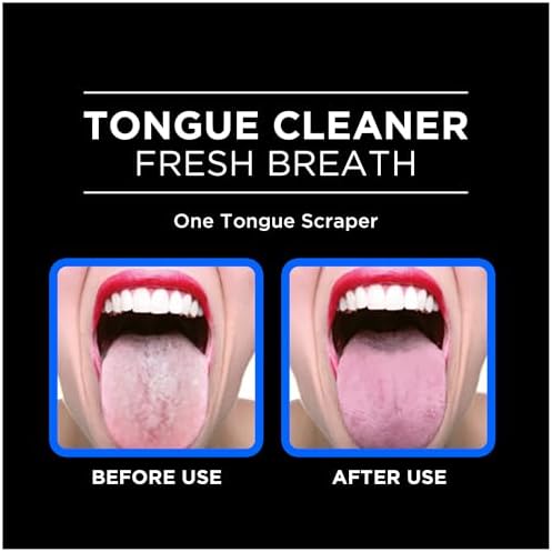 DenTek Orabrush Tongue Scraper, Gentle Tongue Cleaner Brush for Fresh Breath, 2 Count