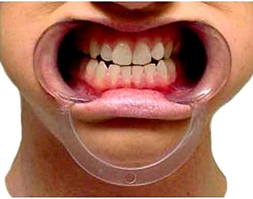 15 pcs Speak Out Dental Cheek Retractor Watch Ya Mouth Game C Adult Kids Teeth Whitening Mouth Opener S M L Blue Clear -Large