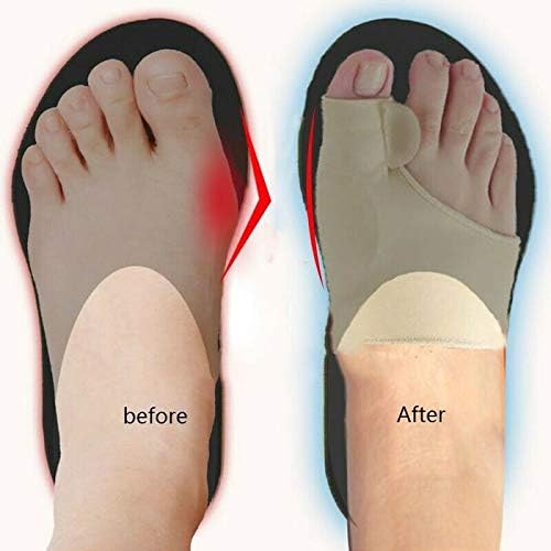 HiiBaby 2PCS Toe Separator Hallux Valgus Bunion Corrector Orthotics Feet Bone Thumb Adjuster Correction Pedicure Sock Straightener