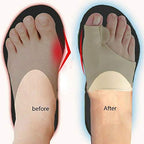 HiiBaby 2PCS Toe Separator Hallux Valgus Bunion Corrector Orthotics Feet Bone Thumb Adjuster Correction Pedicure Sock Straightener