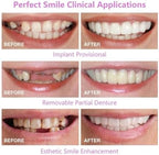 2 Pairs, Nature and Comfortable Top and Bottom, Regain Confidence Smile for Men and Women (2)