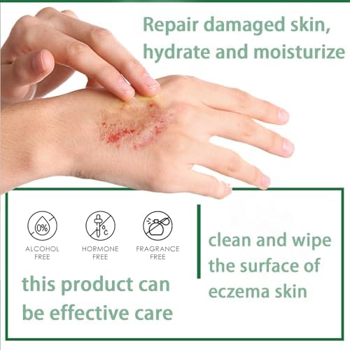 Aacnre Ecz𝗲ma Th𝗲𝗿apy Spray, Effective 7-Day Moisturizing Hand Cream Body Spray, An𝘁𝗶b𝗮c𝘁erial Natural Soothing P𝘀𝗼𝗿i𝗮𝘀is Crema, Ointment for Natural Relief of Skin Problems