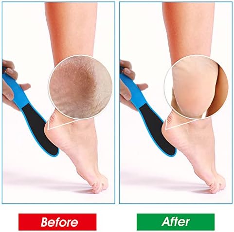 WLLHYF 4 Pieces Double Sided Pedicure Foot File Foot Scraper, Exfoliator Remover Dead Skin Hard Skin Calluses Foot Scrubber Reusable Foot Care Pedicure Tool for Wet and Dry Cracked Feet 2 Sizes