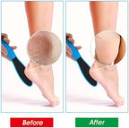 WLLHYF 4 Pieces Double Sided Pedicure Foot File Foot Scraper, Exfoliator Remover Dead Skin Hard Skin Calluses Foot Scrubber Reusable Foot Care Pedicure Tool for Wet and Dry Cracked Feet 2 Sizes