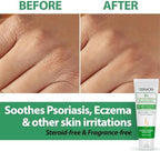 2% Colloidal Oatmeal Eczema Lotion - Soothing and Moisturizing Anti-Itch Cream & Body Lotion with Aloe Vera, Shea and Glycerin - Nourishing Eczema Cream for Superior Relief and Protection 8oz