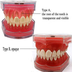 Standard Teeth Model, Dental Crown Models Soft Gums, Dental Model Resin Removable Full Mouth Teeth for Tooth Extraction Exercises, Doctor Explains to The Patient