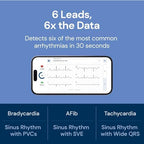 KardiaMobile 6L Max EKG Monitor, Includes One-Year KardiaCare Subscription, FDA-Cleared Heart Monitor, Medical-Grade Results in 30 Seconds, Unlimited Recordings, Works with Smartphones and Tablets