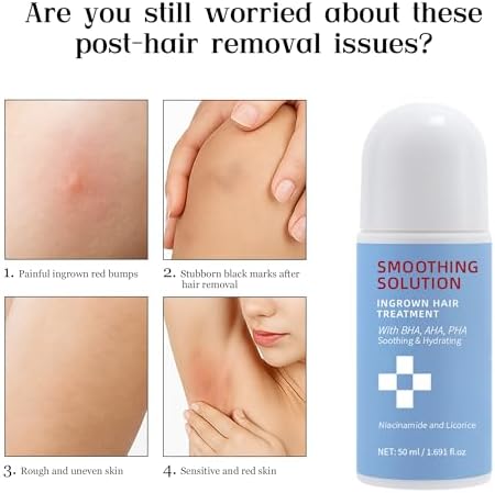 Smoothing Solution Ingrown Hair Treatment,ingrown hair serum,moisturizing, gently soothing, suitable for both men and women, and compatible with all skin types,1.7 FL.OZ,1 PCS
