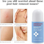 Smoothing Solution Ingrown Hair Treatment,ingrown hair serum,moisturizing, gently soothing, suitable for both men and women, and compatible with all skin types,1.7 FL.OZ,1 PCS