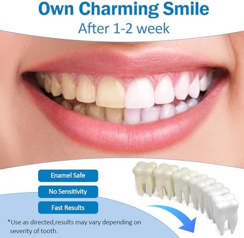 KTSAY Teeth Whitening Pen - Professionally Stain Removal Teeth Whitening Gel Formula, No Sensitivity Effective Teeth Whitener, Mint (0.11 Fl Oz (Pack of 4))