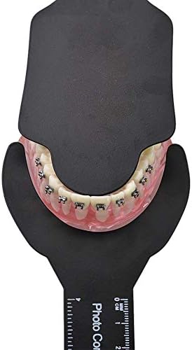 Dental Photo Contrast Black Background Board Autoclavable Dental Orthodontic Oral Cheek Retractors Photographic Black Background Backdrop (6Pcs)