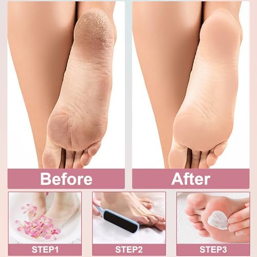 36 Pieces Flat Shaped Foot File Foot Callus Remover with Double Sided Feet Rasp Professional Pedicure Foot File for Grit Exfoliates Removes Dead Skin,3 Colors