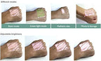 Vein Viewer Pro - Vein Finder Locator & Illuminator for IV & Veinpuncture AC/Battery