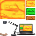Infrared Vein Finder for Iv Access, Adjustable Venous Image with Vascular Enlargement, Portable Vascular Vein Viewer Light for Children Adult Elderly, Medical Vein Image Display Instrument
