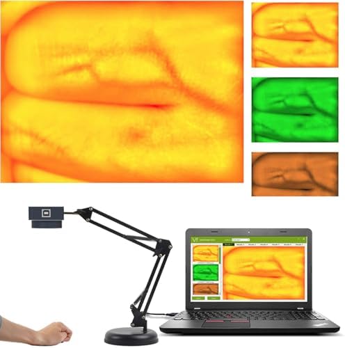 Infrared Vein Finder for Iv Access, Adjustable Venous Image with Vascular Enlargement, Portable Vascular Vein Viewer Light for Children Adult Elderly, Medical Vein Image Display Instrument