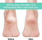 Vaincre Gel Moisturizing Heel Socks for Dry Cracked Feet Women, 4 Pairs Foot Care Spa Moisture Toeless Socks for Cracked Heel Repair Treatment Overnight (Regular)